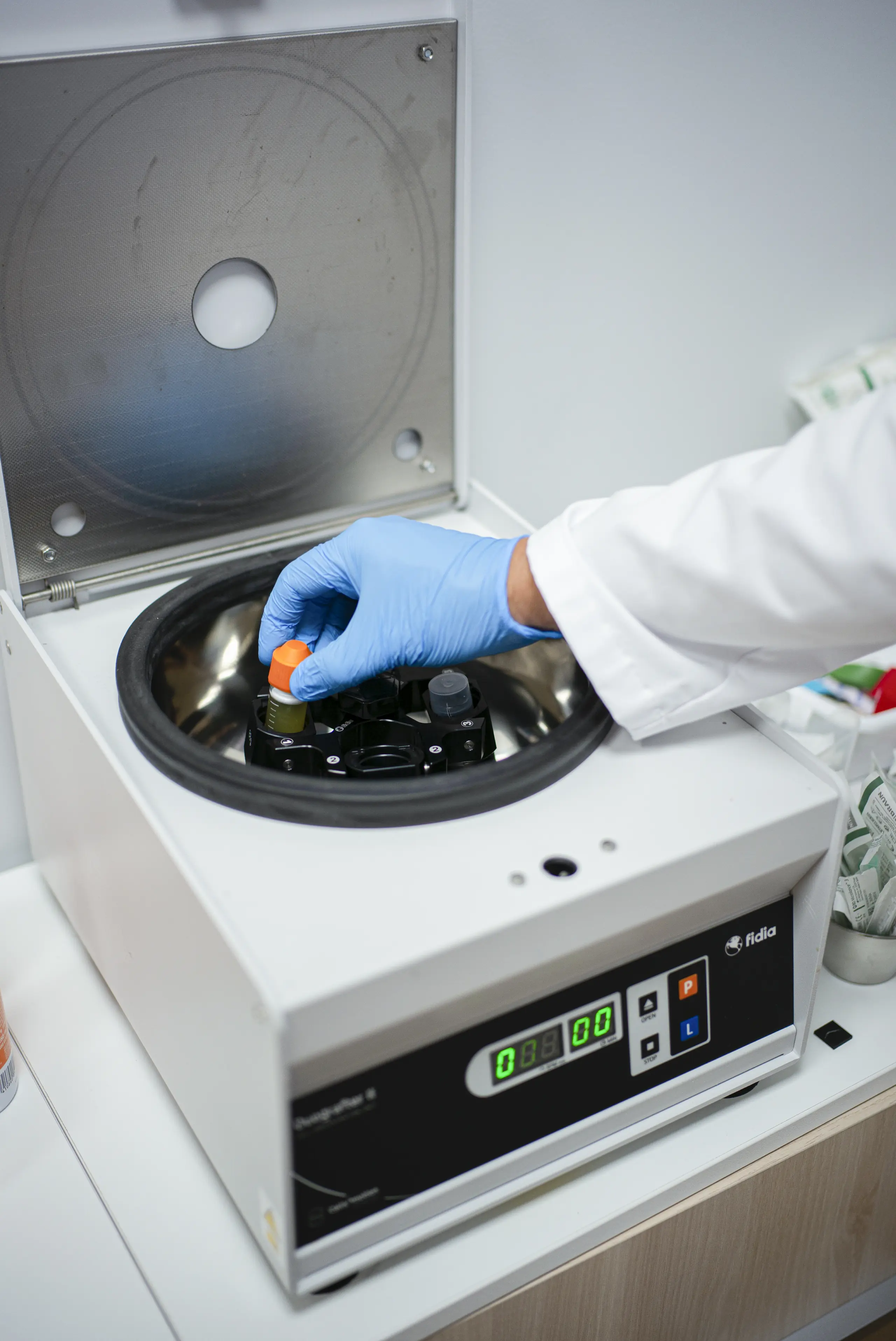 Tubo de sangre colocado en la centrifugadora para preparar plasma rico en plaquetas — Traumatología Mugisalud Bilbao